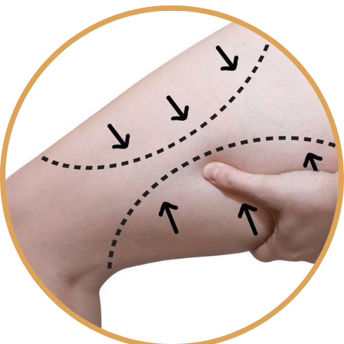 شد ترهلات الأفخاذ