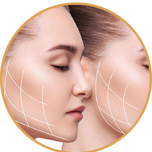 Cheek fat removal (face contouring)