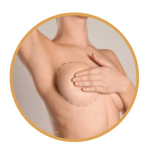 شد ترهل الثدي