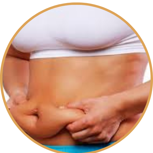 شد ترهلات الجسم بعد فقدان الوزن