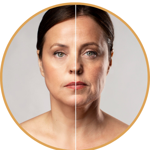 شد الوجه الغير جراحي