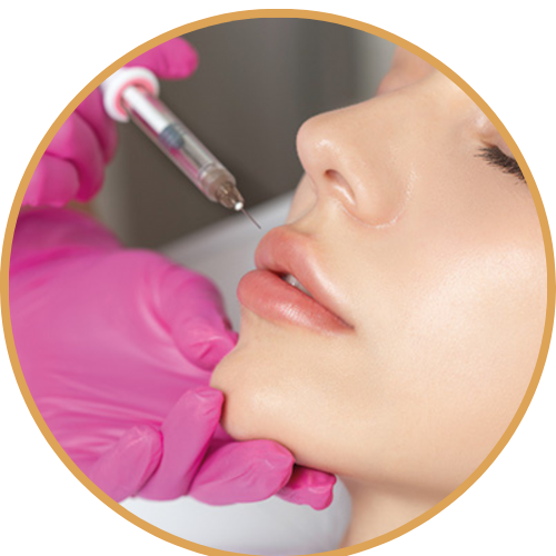 خدمات الفيلر