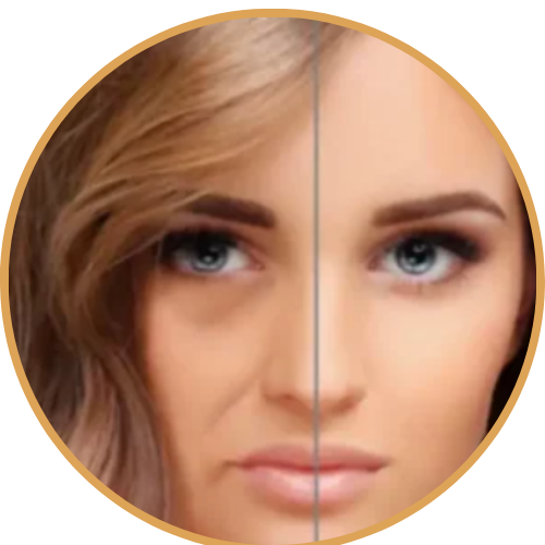 Autologous fat injection in the face